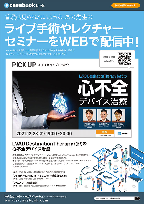 LVAD Destination Therapy時代の心不全デバイス治療